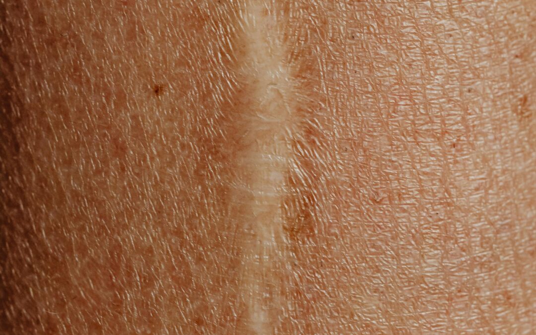 Skin Camouflage Expert Witness