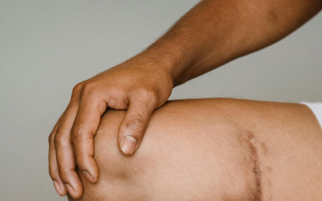 Medico-legal Scar Report