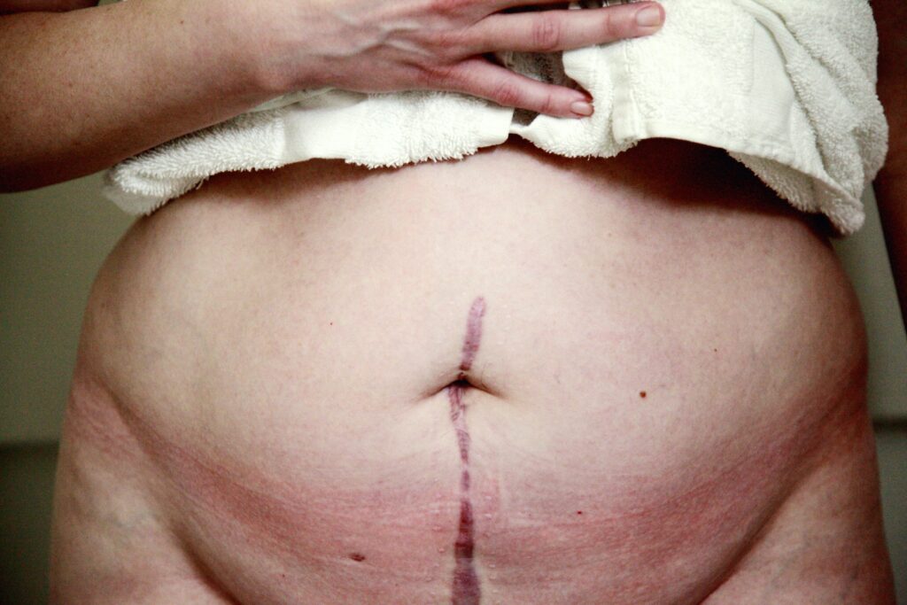 Expert Witness Scar Reports 1 expert witness scar reports