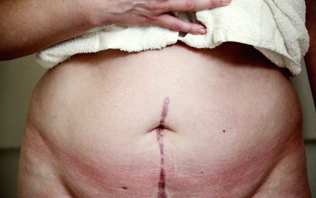 Expert Witness Scar Reports