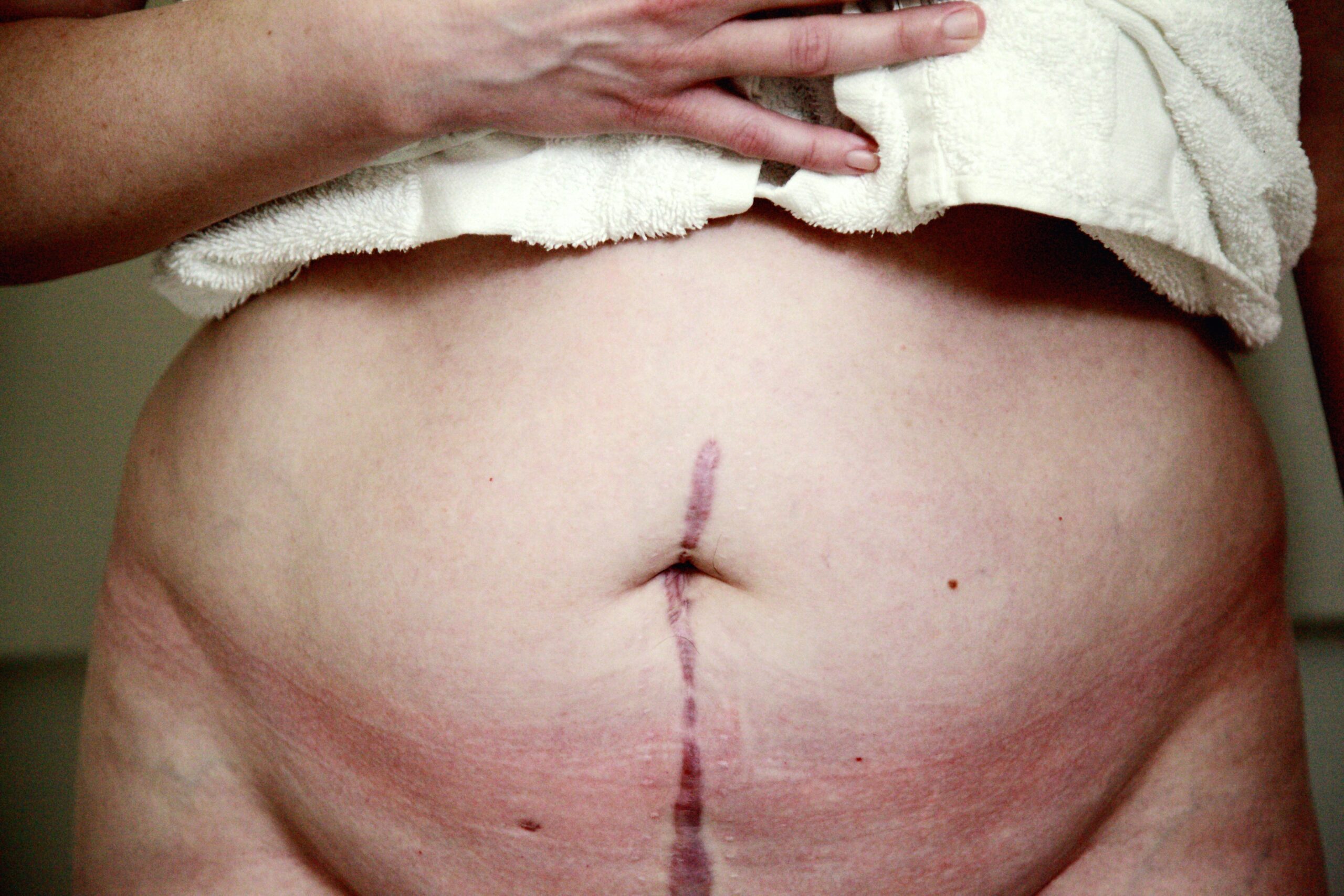Expert witness scar reportss expert witness scar reports