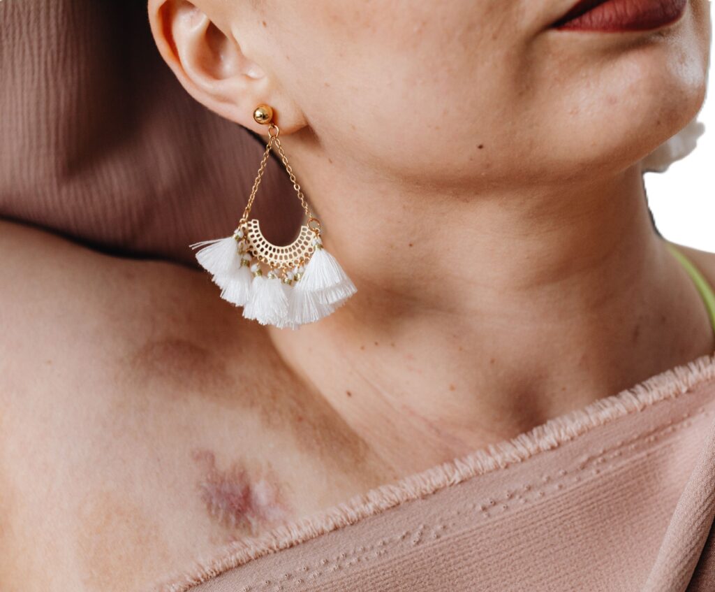 Expert Witness Scarring Reports 1 expert witness scarring reports